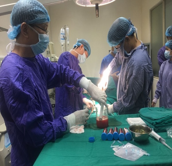 Phương pháp mới điều trị ‘đột quỵ não’ từ tế bào gốc tự thân-dulichgiaitri.vn Phương pháp mới điều trị ‘đột quỵ não’ từ tế bào gốc tự thân-dulichgiaitri.vn