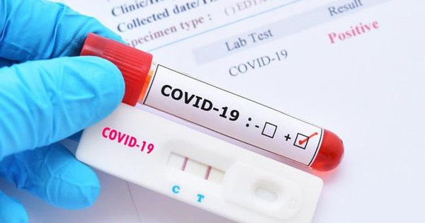 16 loại test nhanh kháng nguyên SARS-CoV-2 được Bộ Y tế ‘cấp phép’-dulichgiaitri.vn