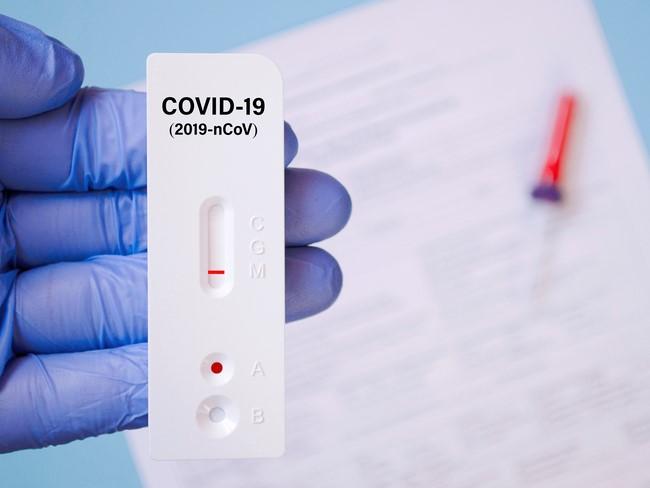 Bộ Y tế làm rõ phản ánh giá xét nghiệm COVID-19 ở mức cao-dulichgiaitri.vn