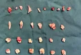 Cô gái đau bụng dữ dội, bác sĩ phát hiện ra bí mật bên trong