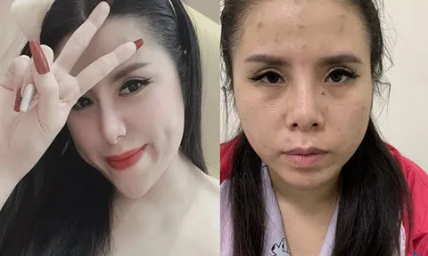 Vụ bắt hot girl Facebook Nabi Phương bán "nước nho ma túy": Bất ngờ dung mạo khi bị bắt