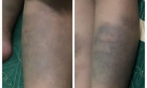Đà Nẵng: Tạm đình chỉ đứng lớp cô giáo để học sinh bị bạo hành
