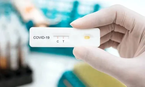 Cách tiết kiệm test nhanh Covid-19 khi tự xét nghiệm tại nhà