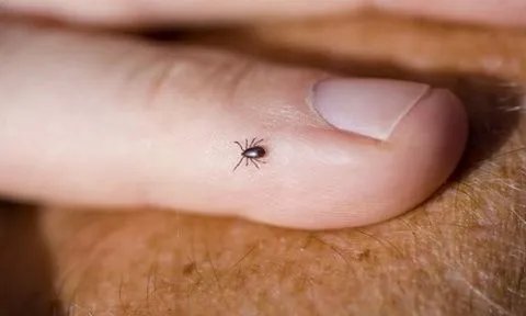Đáng sợ bệnh "khóc ra máu", có thể gây tử vong tới 40% chỉ sau cơn sốt