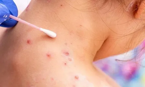 Tin tức Đời sống 27/5: Nguy kịch vì căn bệnh quen thuộc