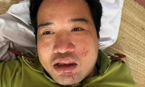 Thanh Hóa: Điều tra vụ trạm trưởng kiểm lâm bị xe đâm trong đêm