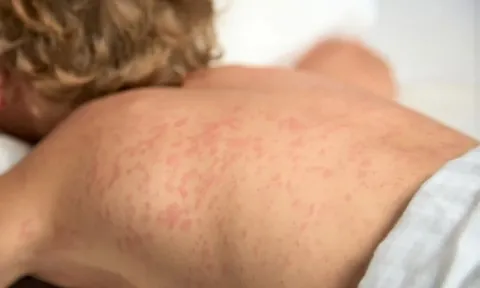Tp.HCM: Lo ngại nguy cơ những bệnh truyền nhiễm nguy hiểm hoành hành