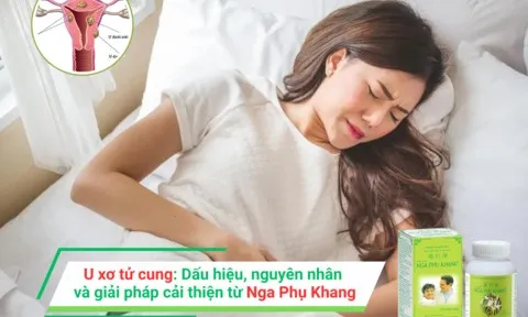 U xơ tử cung: Dấu hiệu, nguyên nhân và giải pháp cải thiện từ Nga Phụ Khang
