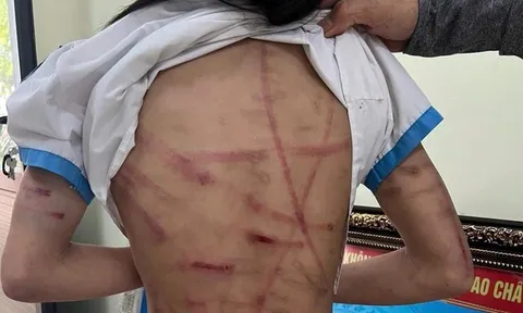 Thương bao nhiêu, giận bấy nhiêu...