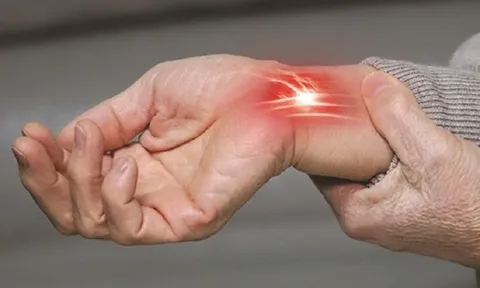 Hội chứng ống cổ tay