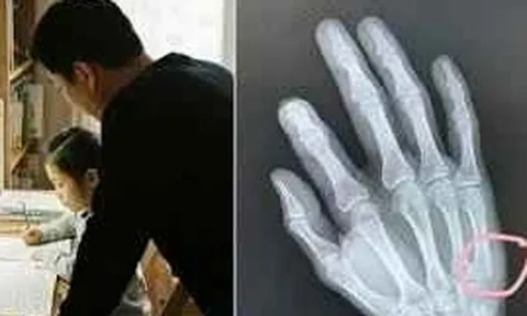 Con viết 18 chữ sau 30 phút học, người cha tức giận đập bàn… và cái kết khó tin