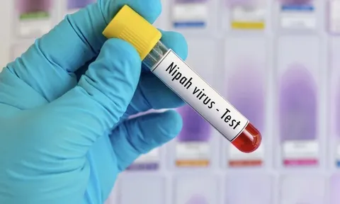 Không chủ quan với dịch bệnh do virus Nipah