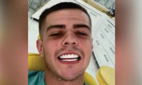 Gửi ảnh "khoe hàm răng mới" cho bạn, kẻ buôn ma túy bị bắt