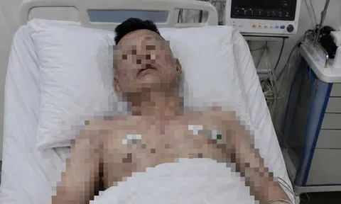 Người đàn ông 46 tuổi tử vong trên giường, bác sĩ cảnh báo loại đồ uống quen thuộc "vạn người mê"