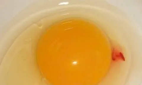 Vì sao lòng đỏ trứng lại có đốm máu? Câu trả lời khiến nhiều người bất ngờ