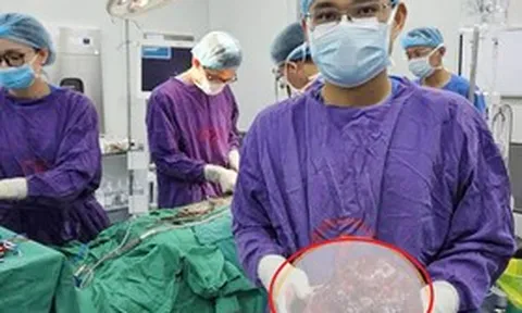 Bụng to bất thường, người đàn ông sốc khi bác sĩ gắp ra thứ "đáng sợ" nặng 2kg bên trong