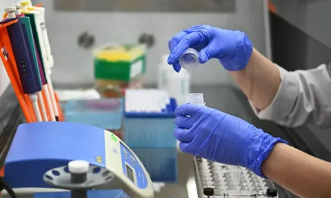 Có thể ‘dự đoán’ mức độ nặng của bệnh COVID-19 qua nước bọt?