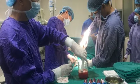 Phương pháp mới điều trị ‘đột quỵ não’ từ tế bào gốc tự thân