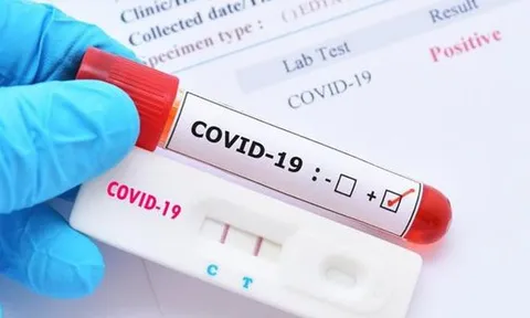 16 loại test nhanh kháng nguyên SARS-CoV-2 được Bộ Y tế cấp phép
