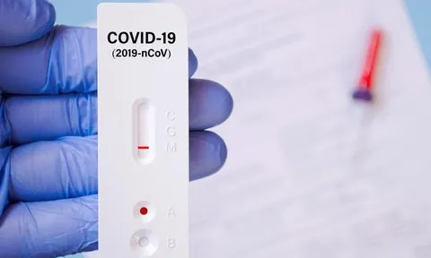 Bộ Y tế làm rõ phản ánh giá xét nghiệm COVID-19 ở mức cao