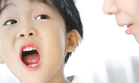 Trẻ nói ngọng... không thể xem thường
