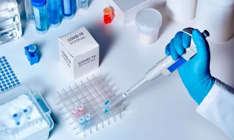 Người bệnh không phải chi trả phí xét nghiệm COVID-19 khi đến khám và điều trị tại các cơ sở y tế công lập