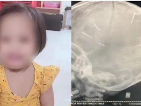 Bé gái 3 tuổi bị người tình của mẹ bắn đinh vào đầu đã tử vong