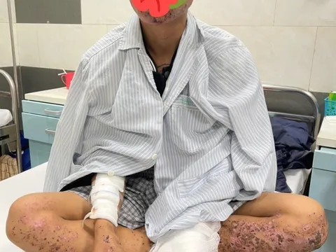 Cảnh báo: Cháy sém toàn thân, mất thị lực do dùng điện thoại khi đang sạc