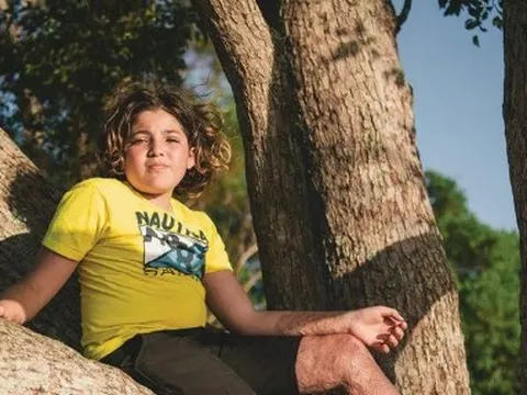 Xót xa cậu bé 12 tuổi phải trải qua 50 cuộc phẫu thuật vì làm theo thử thách trên TikTok