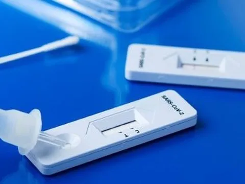 Thực hư việc kit test nhanh Covid-19 có chứa độc tố