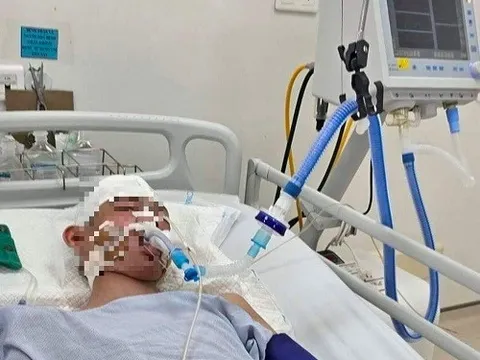 Cần nghiêm trị hành vi bạo lực trẻ em