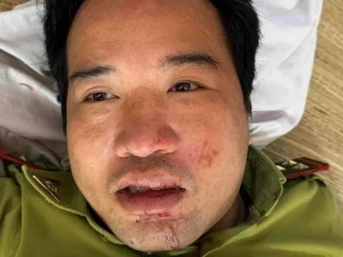Thanh Hóa: Điều tra vụ trạm trưởng kiểm lâm bị xe đâm trong đêm