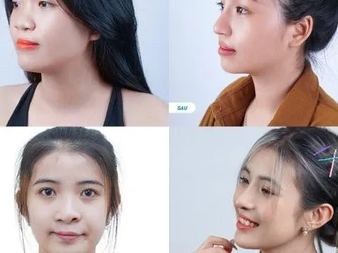 “Hoàng tử V-pop” Hoàng Hải: Rất lâu rồi chưa “vướng vào lưới tình”