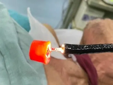 Cụ ông 74 tuổi phải nhập viện cấp cứu vì tai nạn hi hữu