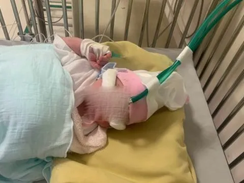 Đồng Nai: Cứu sống 2 mẹ con sản phụ bị ngã xe