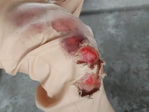 Cảnh sát giao thông vây bắt 3 đối tượng dùng dao chém người cướp tài sản