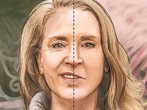 Nhận biết sớm dấu hiệu cảnh báo đột quỵ