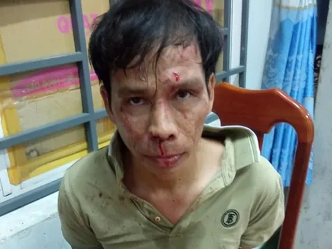 Bà Rịa - Vũng Tàu: Tạm giữ đối tượng dùng hung khí tấn công Thiếu tá Công an