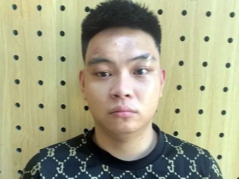 Khởi tố gã trai mất nhân tính hành hạ con vợ hờ phải nhập viện