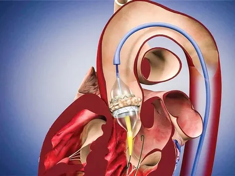 Chờ kết luận từ Hội đồng chuyên môn về ca tử vong ở Đắk Lắk liên quan 3 bác sĩ BV Bạch Mai