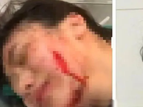 Thanh Hóa: Điều tra vụ mẹ nợ tiền, con gái bị rạch mặt