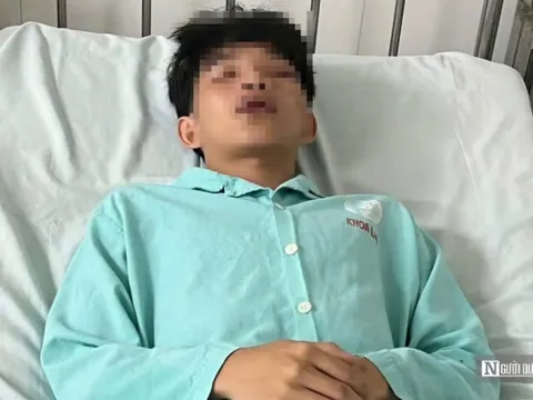 Điều tra vụ mâu thuẫn trong giờ ra chơi, một học sinh bị đánh nhập viện