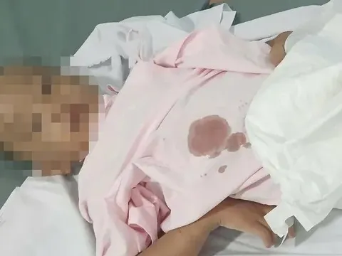 Bắt cặp tình nhân bạo hành bé trai 6 tuổi ở TP.HCM