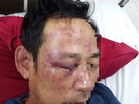 Quảng Bình: Điều tra vụ người đàn ông bị 8 người đánh nhập viện