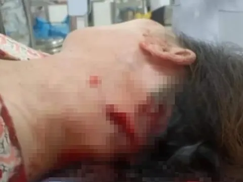 Điều tra vụ kẻ bán hàng rong truy sát người bán thịt