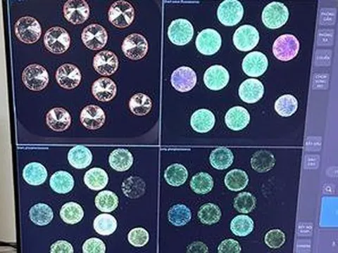 Triệt phá vụ vận chuyển gần 720 viên kim cương tại sân bay, bắt giữ người đàn ông Ấn Độ