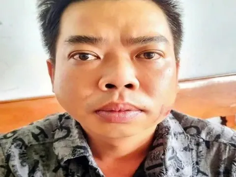 Mâu thuẫn khi hát karaoke, người đàn ông tấn công bạn nhậu