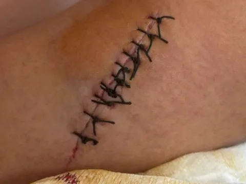 Khẩn trương truy tìm toán cướp dùng dao và kim tiêm gây án lúc rạng sáng