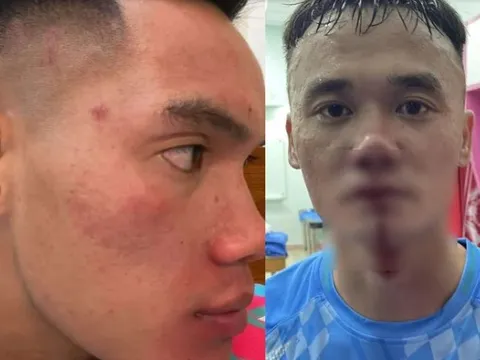 2 cầu thủ giải hạng Nhất đối mặt án phạt nặng vì đánh nhau trên sân Thống Nhất