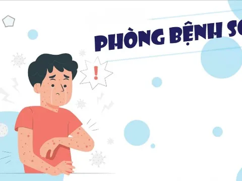 Infographics: Bệnh sởi và các biện pháp phòng bệnh